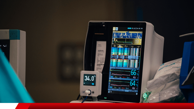 Monitor multiparamétrico exibindo sinais vitais em ambiente médico.